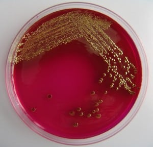 E. Coli 